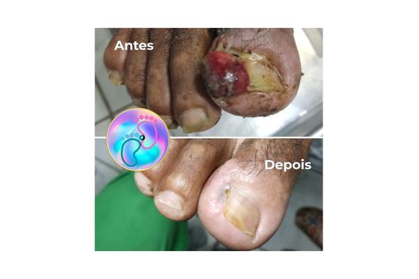 Foto de antes e depois do tratamento 47